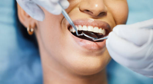 Best Emergency Root Canal Treatment in Happy Valley, OR