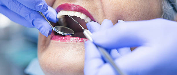 Best Emergency Treatment for Toothache in Happy Valley, OR